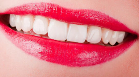 4 useful tips for sparkling pearly white teeth