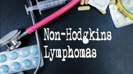 6 common risk factors for Non-Hodgkin lymphoma