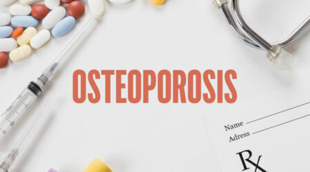 Bone density testing &#8211; An important diagnostic tool for osteoporosis