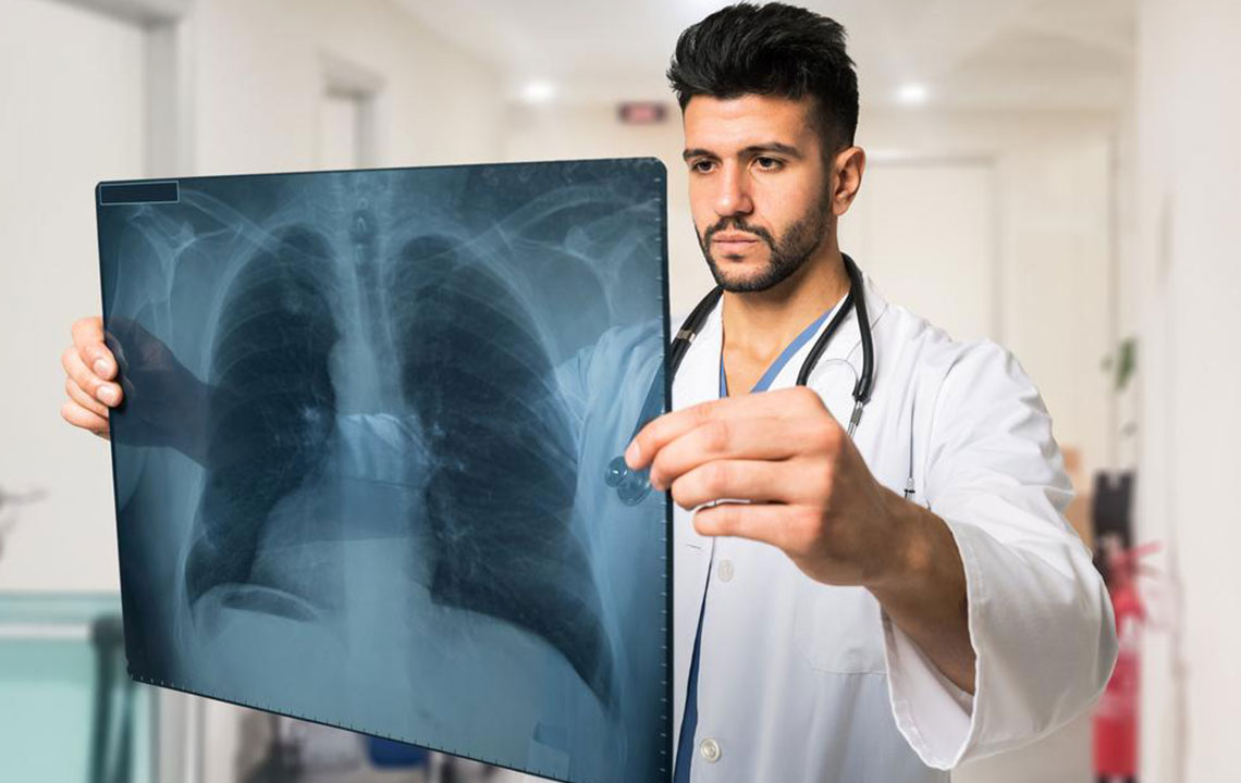 Signs and symptoms of lung cancer