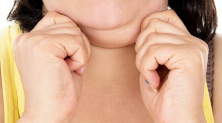 Struggling with a double chin? Here&#8217;s how you can get rid of it