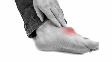 Top triggers for gout foot pain