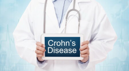 Causes, symptoms, and remedies for Crohn&#8217;s disease