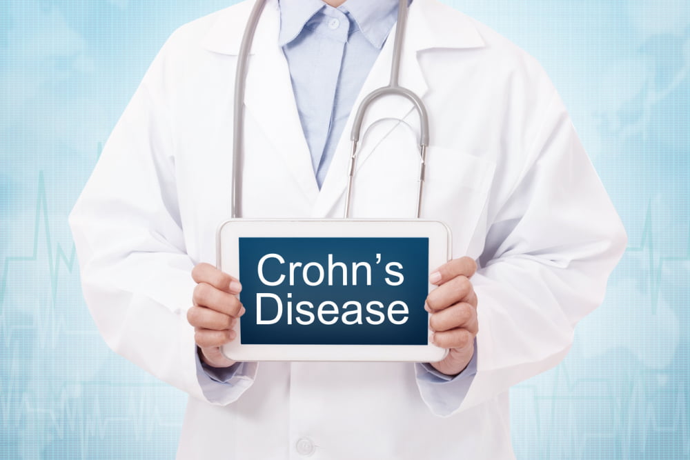 Causes, symptoms, and remedies for Crohn&#8217;s disease